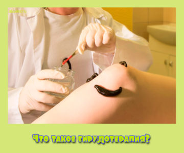 Что такое гирудотерапия?