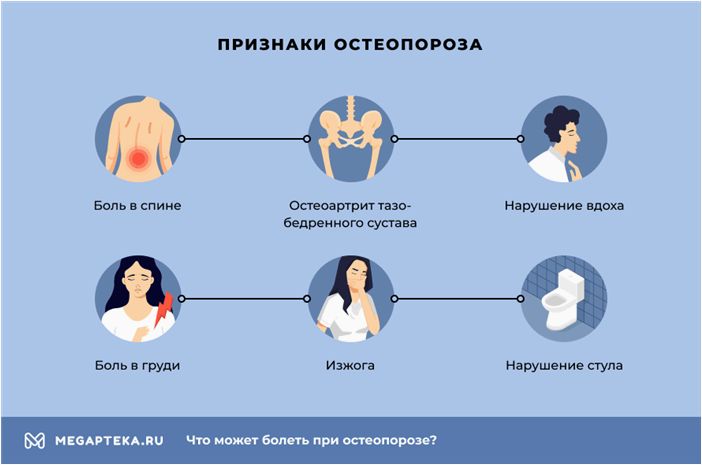 Симптомы и лечение Остеопороза